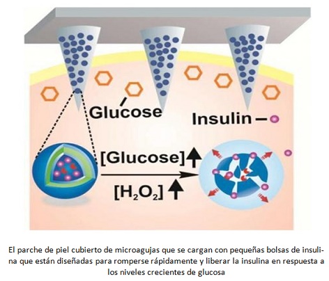 galope efectivo Anguila Crean un parche 'inteligente' que suministra insulina a pacientes con  diabetes tipo 1 y tipo 2 - iSanidad