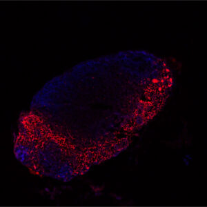 biopsia-líquida-cnio