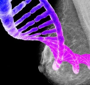 cancer-de-mama-plataformas-genómicas