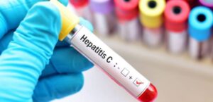 sistema-alerta-hepatitis C