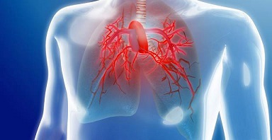 Hipertensión-pulmonar-