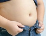 obesidad-sindrome- Bardet-Biedl