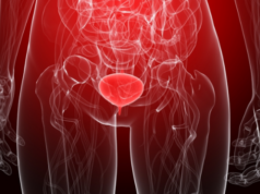 cáncer-urotelial-avanzado-enfortumab-vedotina