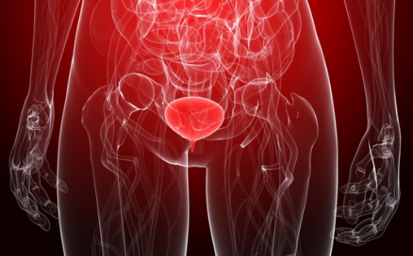 cáncer-urotelial-avanzado-enfortumab-vedotina