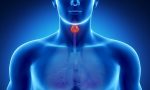 cáncer-de-tiroides