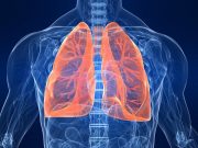 Boehringer-fibrosis-pulmonar-idiopática