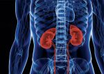 nefritis-lúpica-obinutuzumab