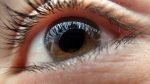 Jiménez-Díaz-ojo-seco financiación enfermedad ocular tiroidea