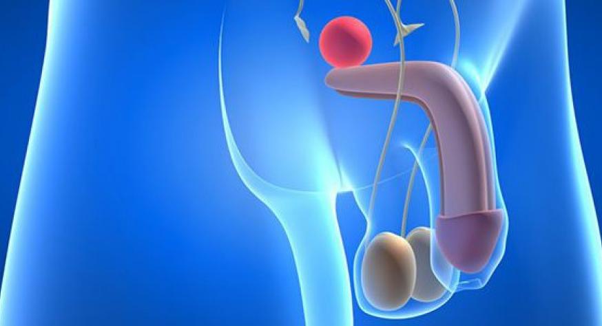Cancer de prostata ultimos avances, Simptomele tratării viermilor