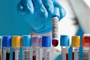 avances-cancer-hematologico