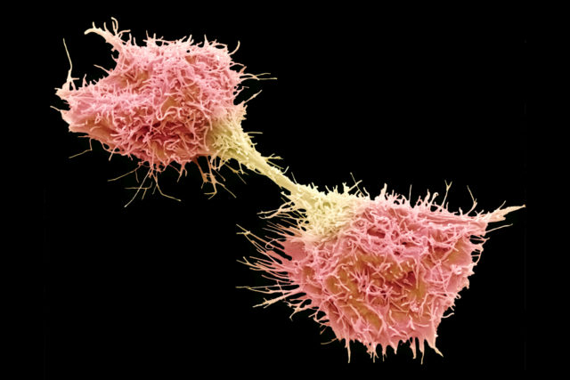 Multi-resistencia-tumores