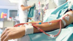 hemodiálisis-extendida- hospitalización-renal