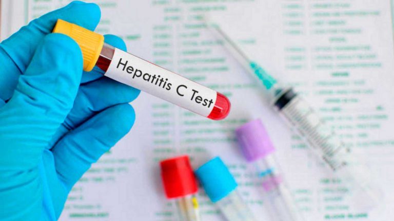 hepatitis-C-urgencias