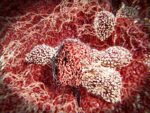 firma genética cáncer páncreas