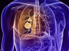 cancer-pulmon-capmatinib