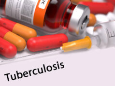 tratamiento-tuberculosis