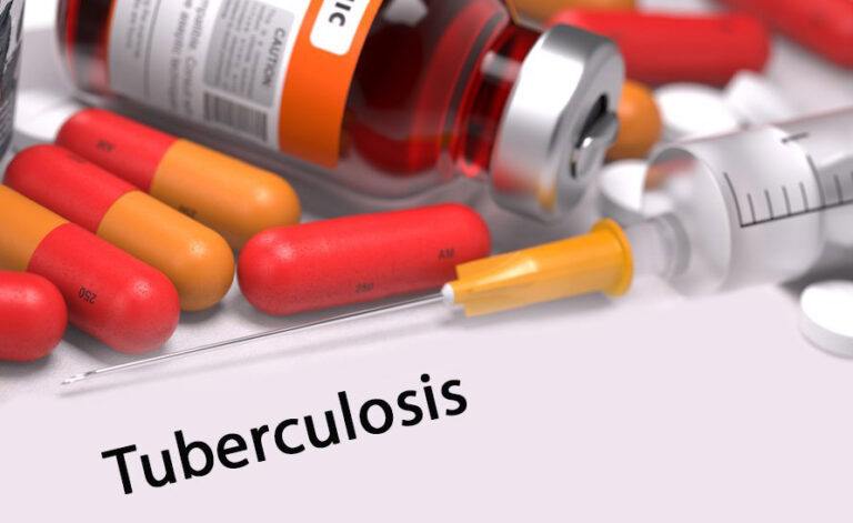 Tuberculosis-farmacorresistente
