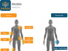 raussa-la-app-para-la-artritis-reumatoide