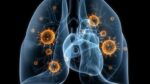 estadios-precoces-cáncer-pulmón