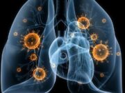 cáncer-pulmón-personalizada