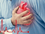 evento-cardiovascular-aterosclerótico