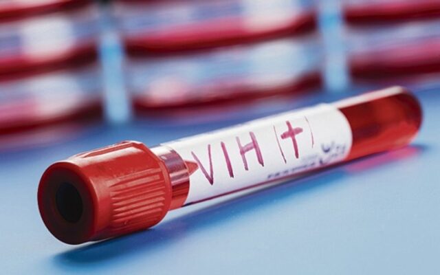 cuidado-holístico-VIH