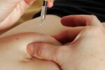 Vacunación-lupus
