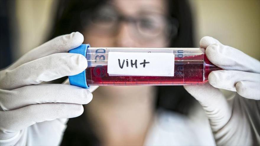 Una investigación revela los pasos esenciales de la infección por VIH
