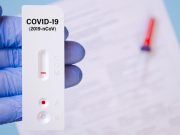 test-covid-19-farmacéuticos