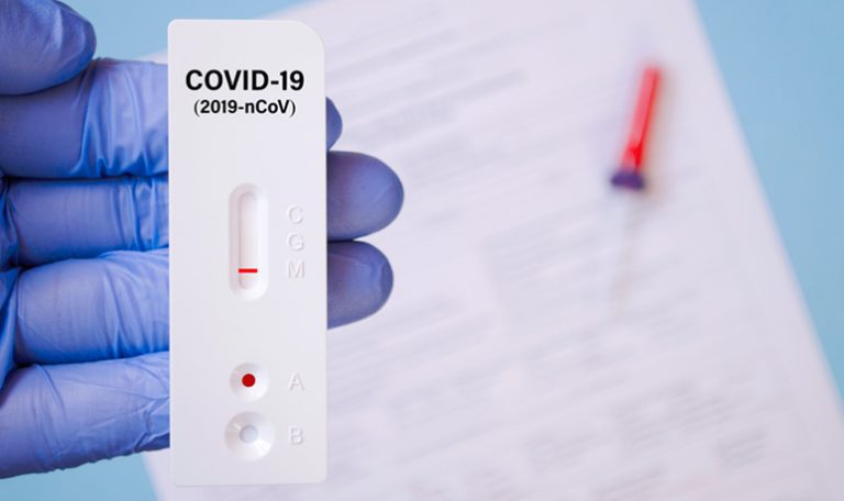 test-covid-19-farmacéuticos