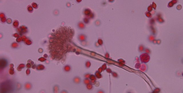 aspergillus-nidulans-aspergilosis-covid-19