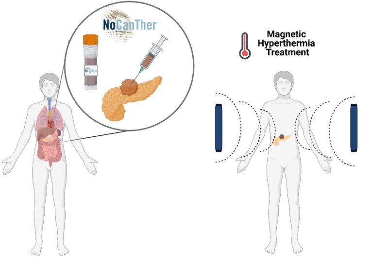 ensayo-clinico-tratamiento-nanoparticulas-cancer-pancreas