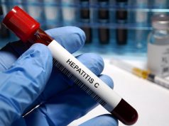 hepatitis-C-proyecto-detect-c