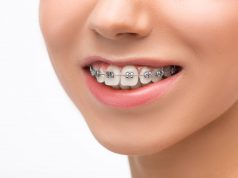 tratamientos-ortodoncia-aumentaron-32%