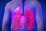 fibrosis-pulmonar-abordaje-multidisciplinar