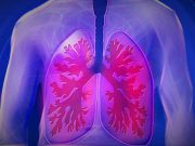 fibrosis-pulmonar