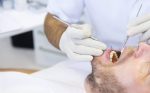 antisépticos-periodontitis