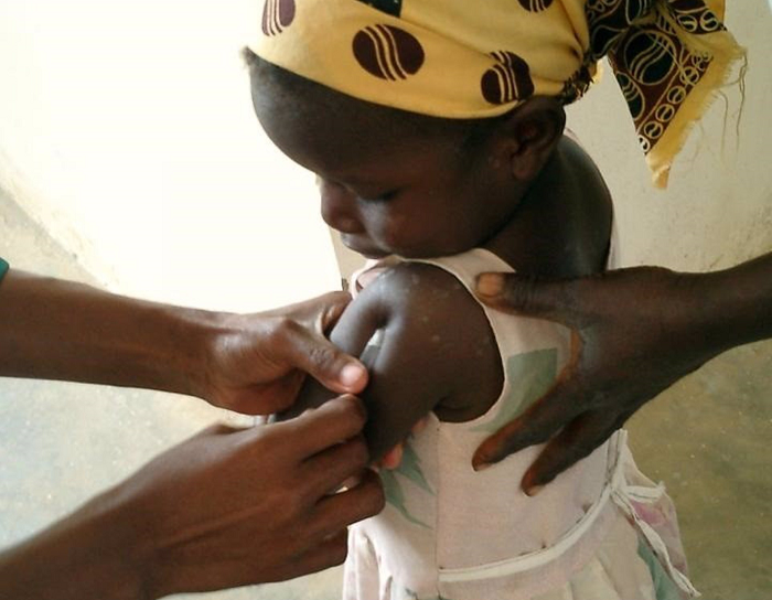 vacuna-malaria-África
