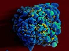 vacuna-ARNm-VIH