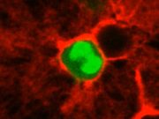 Célula tumoral roedada de colágeno tipo III, parte de la investigación que muestra cómo las células responsables de las metástasis permanecen inactivas
