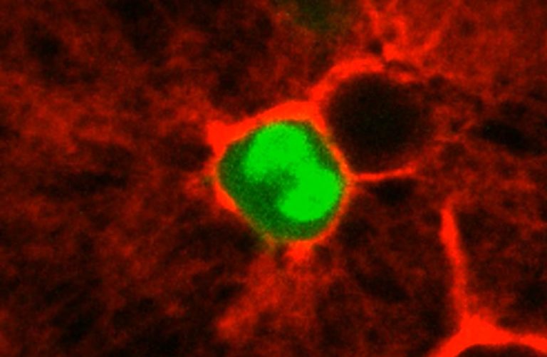 Célula tumoral roedada de colágeno tipo III, parte de la investigación que muestra cómo las células responsables de las metástasis permanecen inactivas