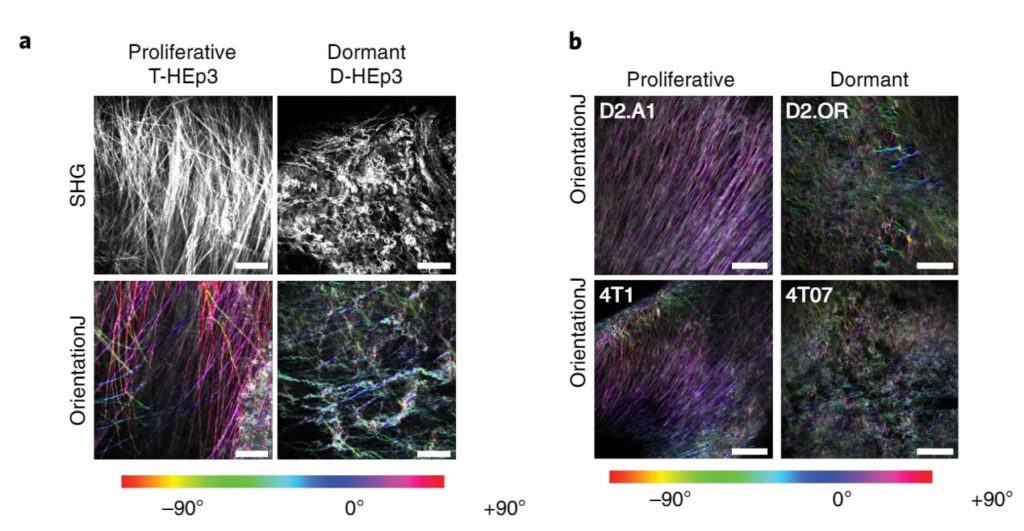 Imágenes del estudio A tumor-derived type III collagen-rich ECM niche regulates tumor cell dormancy