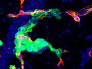 imagen-metastasis-cerebrales-plataforma-cnio