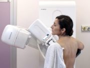 Equipos digitales de Fujifilm para el cribado y diagnóstico del cáncer de mama