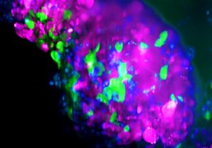 Imagen: Organoide donde las células de color verde son las células madre cancerígenas que no expresan LCOR. Fuente IMIM.