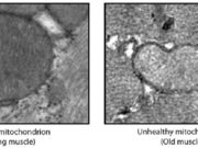 mitocondrias-atrofia-muscular-sarcopenia-envejecimiento