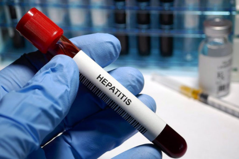 hepatitis-D