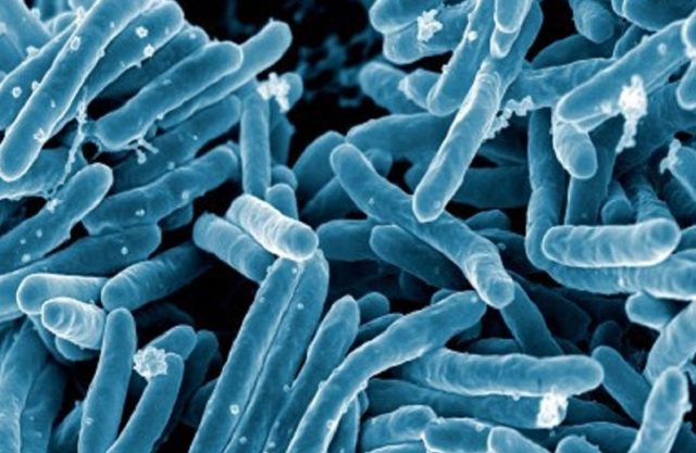 bacterias de tuberculosis