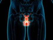 resonancia-magnética-cáncer-próstata