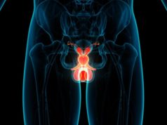 resonancia-magnética-cáncer-próstata